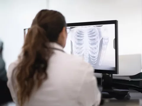 doctor-looks-at-a-computer-screen-with-an-xray