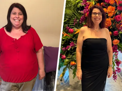 Bariatric Patient melissa-torr